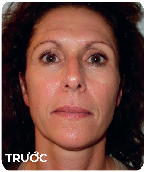 Trước